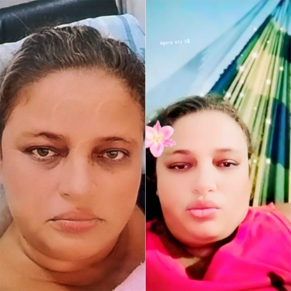 Morte de Terceira Paciente no Centro de Diálise de Mossoró Levanta Preocupações Morte de Terceira Paciente no Centro de Diálise de Mossoró Levanta Preocupações